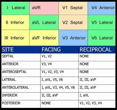 ecg 12 lead normal|12 lead ekg interpretation cheat sheet.